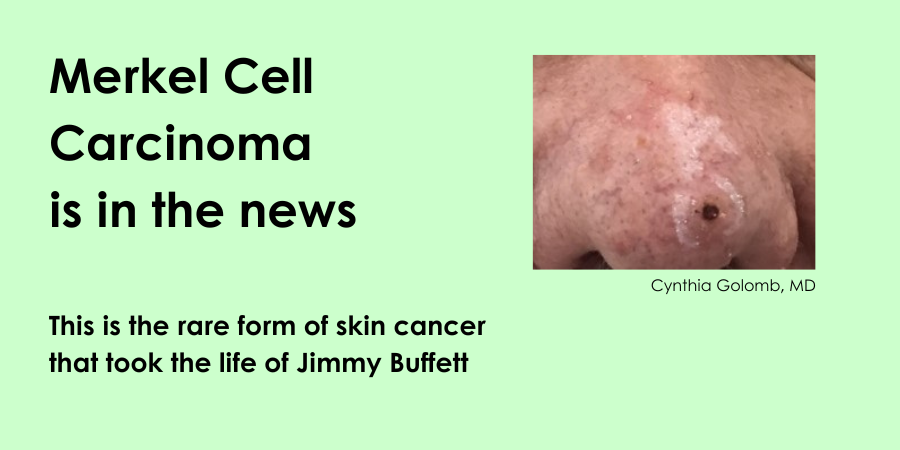 a photo of Merkel Cell Carcinoma on a man's nose